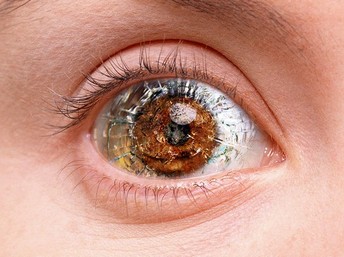Заболевания глаз